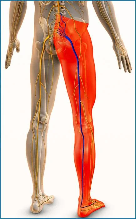 Sharp or burning pain in the lower back or leg